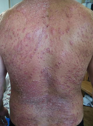 Skin before treatment